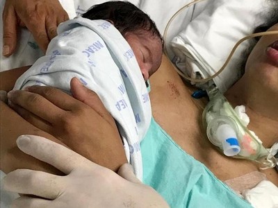 癲癇孕婦昏迷23天喚不醒！醫生把寶寶放在她懷裡，奇蹟發生了