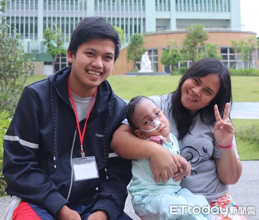 ▲鼻額部「腦膨出」 2歲童「高爾夫球肉瘤」擠成金魚眼。(圖/台北榮總提供)