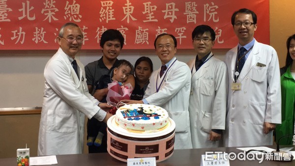 ▲雙眼間恐怖肉瘤竟有「腦組織」 2歲童「腦膨出」一碰就痛。(圖/記者嚴云岑攝)