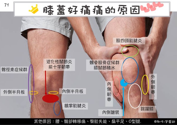 膝盖痛 可以用几个方法先简易判断. 位置-前侧,外侧,内侧,深部,后侧.
