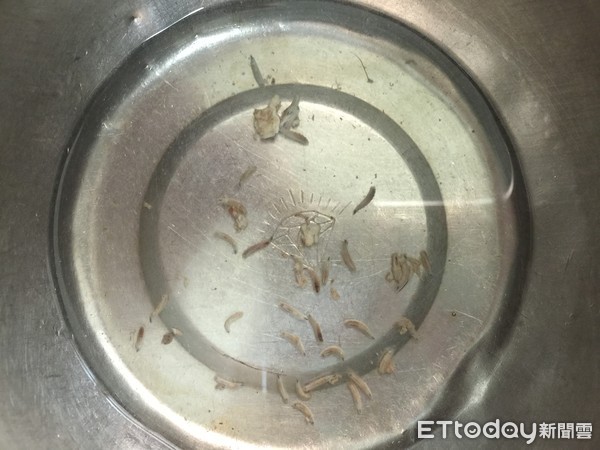 ▲▼85歲老翁鼻孔長蛆。(圖/陳榮峰醫師提供)