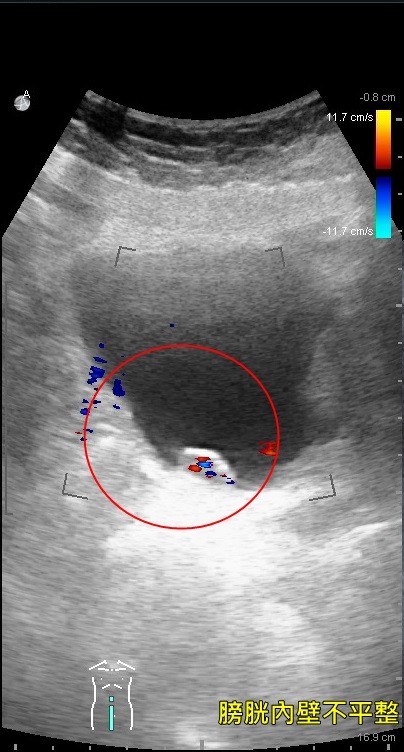 ▲▼膀胱超音波。(圖/亞洲大學附屬醫院提供)