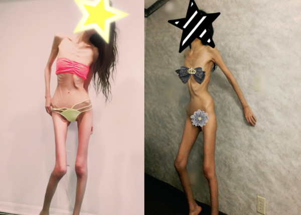 ▲▼厭食症網友。(圖/翻攝自mizukirin001推特)