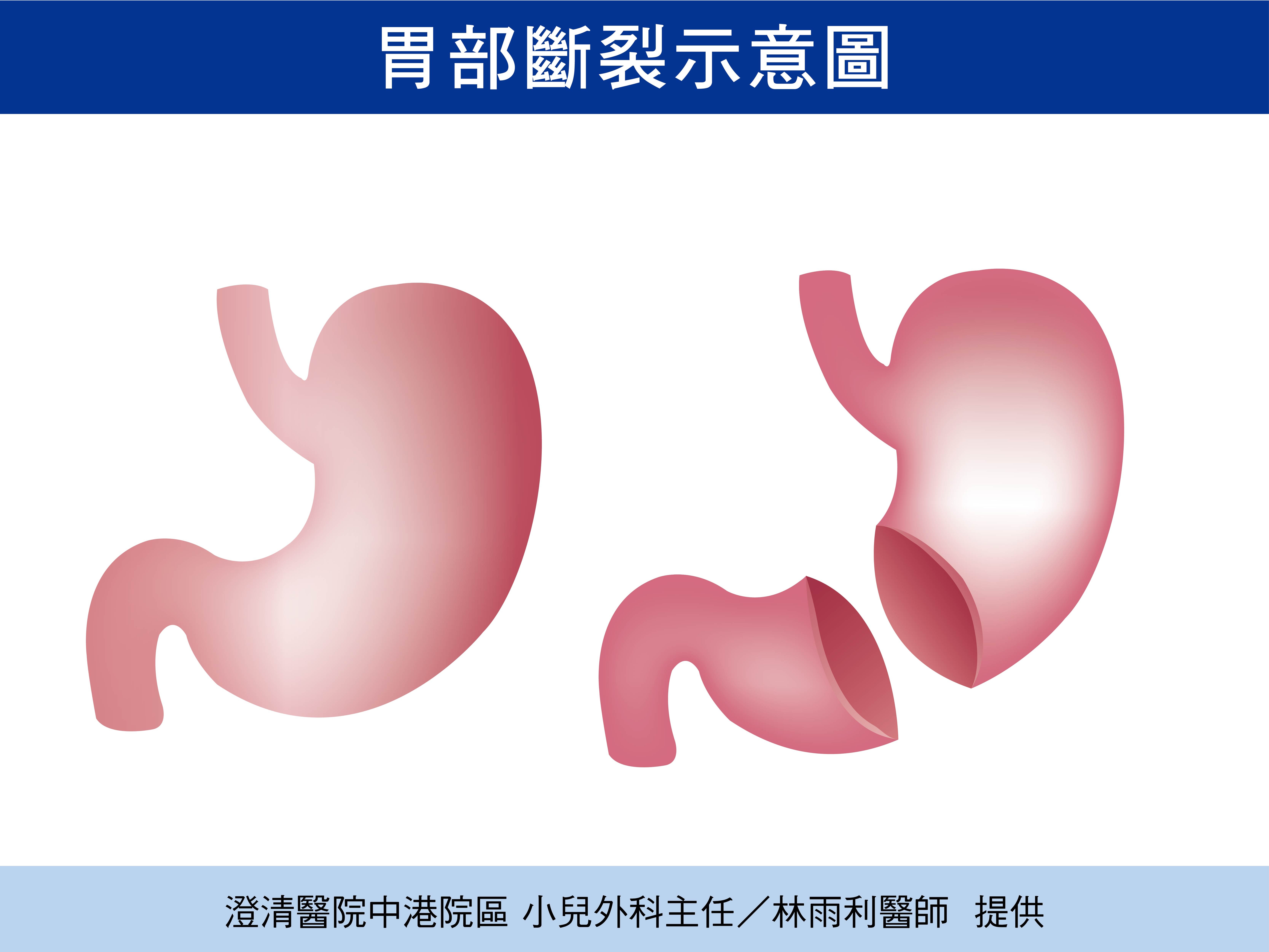 ▲▼。(圖/澄清醫院提供)