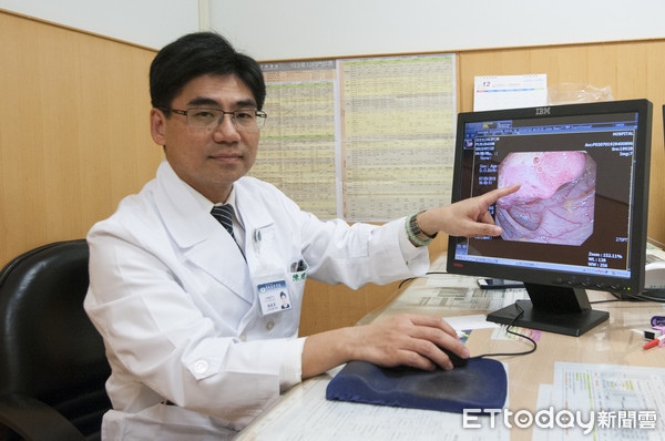 糞便潛血,發現罕見腎癌轉移。(圖/台北慈濟醫院提供)