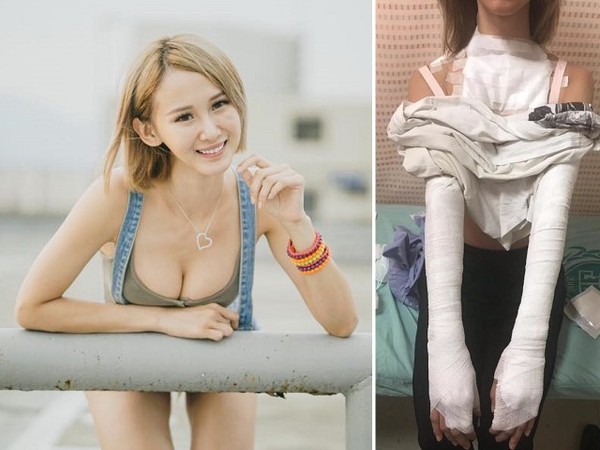 ▲Riva煮東西時遇到油鍋爆炸。(圖/翻攝格鬥美少女 Riva臉書)