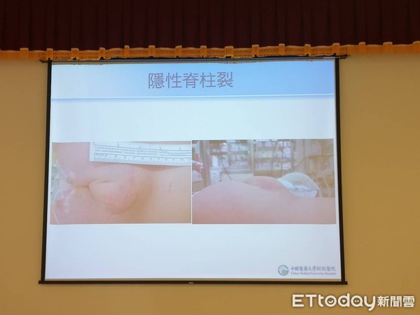 ▲▼。(圖/中國附醫提供)