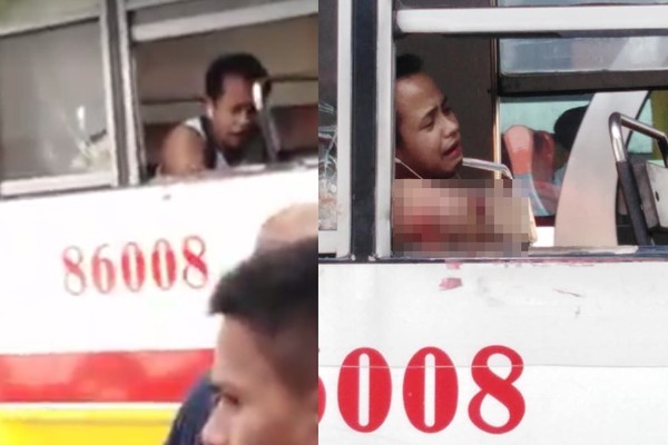 ▲▼菲律賓男坐公車手臂放外面，整支被扯斷。（圖／翻攝自臉書／Aqu Si Val Coe）