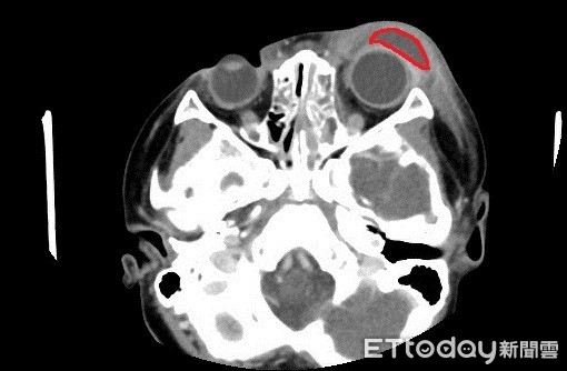 ▲▼。(圖/亞洲大學附屬醫院提供)