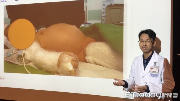 敲小孩肚子發出「碰碰」聲!家長當心 恐藏巨型「畸胎瘤」。(圖/記者嚴云岑攝)