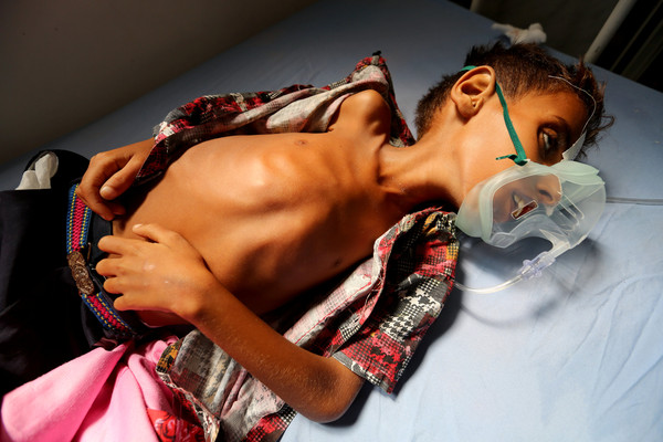▲▼世界糧食計劃署表示葉門目前有超過1400萬人正遭飢餓之苦。（圖／路透）