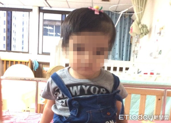 ▲▼潘小妹骨質石化。(圖/高雄醫學大學附設醫院提供)