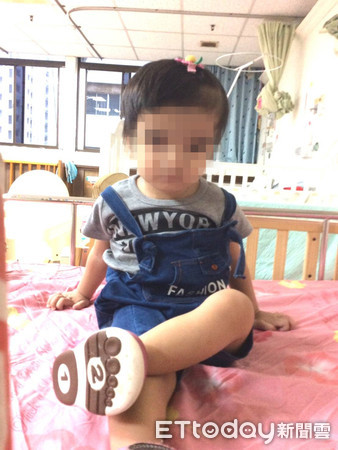 ▲▼潘小妹骨質石化。(圖/高雄醫學大學附設醫院提供)