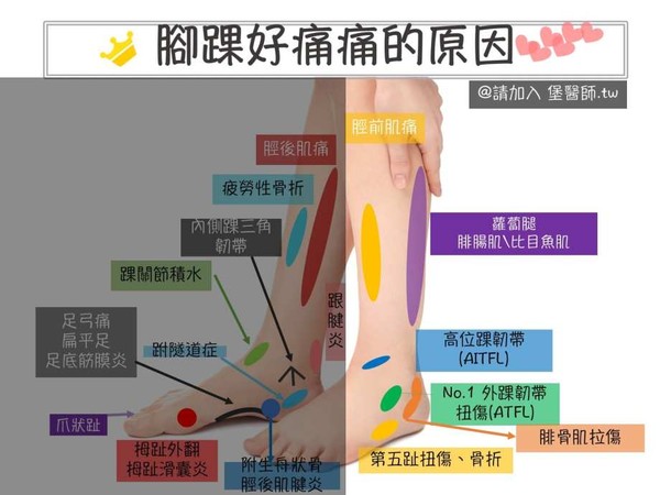 脚踝是哪个部位图解 脚的各个部位详细图_脚目是哪个部位图解