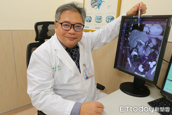 ▲▼。(圖/亞洲大學附屬醫院提供)