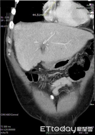 ▲▼。(圖/亞洲大學附屬醫院提供)