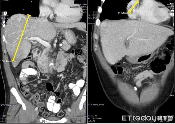 ▲▼。(圖/亞洲大學附屬醫院提供)