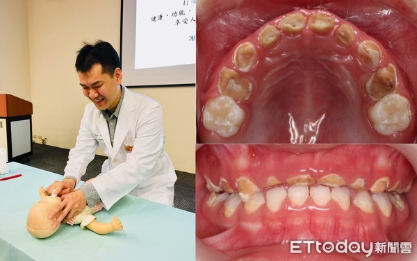▲中國醫藥大學兒童醫院兒童牙科洪仲銳醫師。(圖/中國附醫提供)
