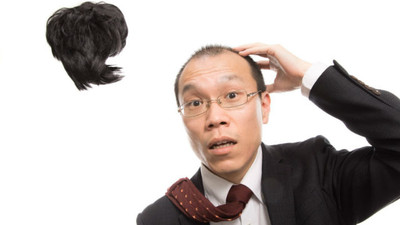 和假髮說掰掰！南韓成功實驗毛囊移植　快去抓身邊頭髮最多的朋友