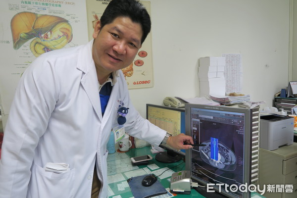 ▲老翁腹痛難忍...竟是魚刺穿腸。(圖/彰化醫院提供)