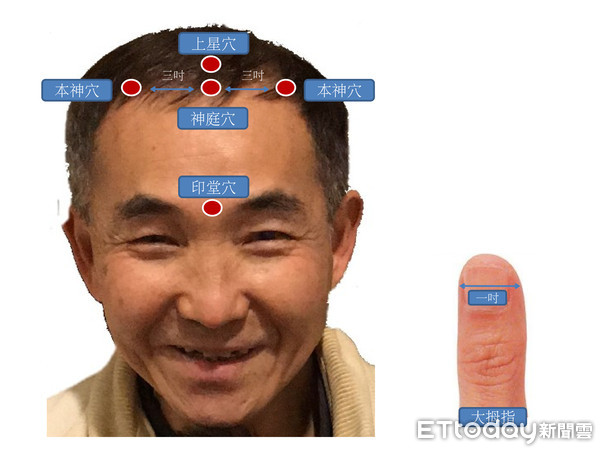▲失智穴位按摩。(圖/陳玟醫師提供)