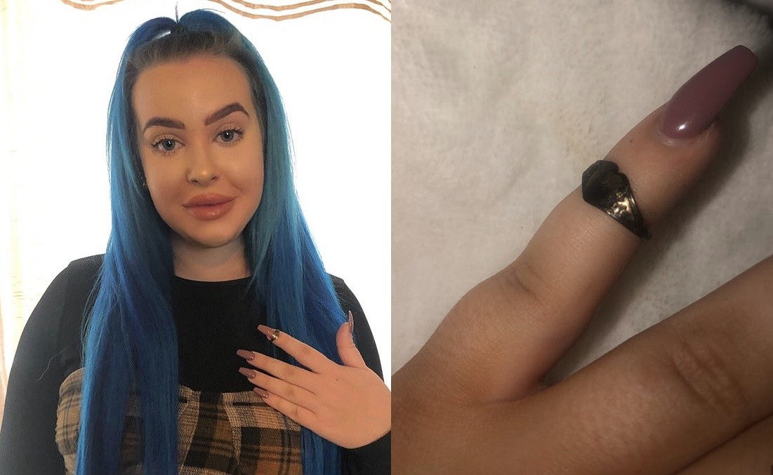 ▲▼英國 女打噴嚏噴出12年前遺失戒指。(圖/翻攝自Triangle news)