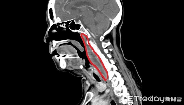 ▲▼。(圖/澄清醫院中港院區提供)