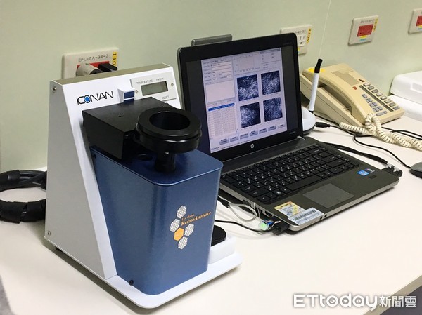 ▲台灣國家眼庫角膜移植。(圖/記者嚴云岑攝)