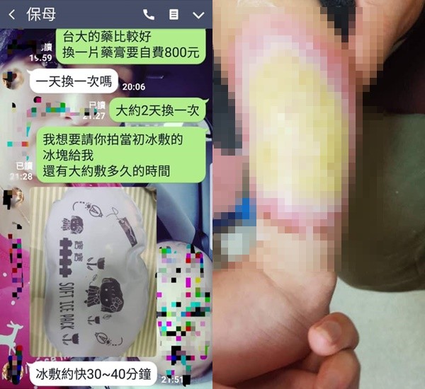 ▲▼屏東1歲童被虐到腿潰爛！母崩潰控保母「燒傷硬扯冰敷」：她還在托嬰！。（圖／翻攝爆料公社）