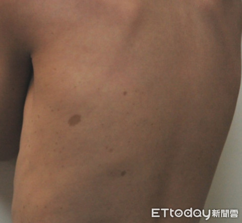 ▲寶寶不到一歲就出現「慣用手」 別高興!可能是腦瘤惹禍。(圖/中國附醫提供)