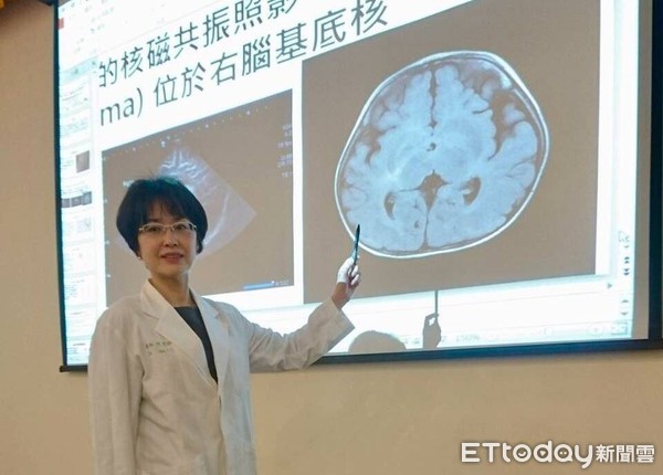 ▲寶寶不到一歲就出現「慣用手」 別高興!可能是腦瘤惹禍。(圖/中國附醫提供)