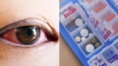 長期熬夜引發紅斑性狼瘡　以為吃藥控制就好？繼續晚睡連視力都有危險