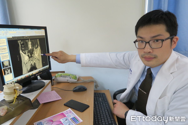 ▲▼ 圖說:陳柏辰醫師。電腦斷層顯示嚴重髖臼骨折(圖右)。(圖/彰化醫院提供)