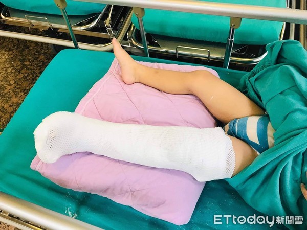 ▲▼家長陪溜滑梯,兒童腳骨折。(圖/黎博彥診所提供)