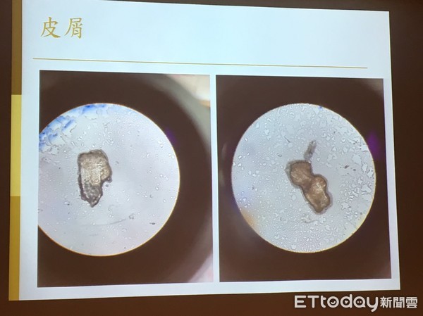 ▲掀開蟎蟲狂蠕動!她針眼半年好不了 問題竟在「假睫毛」。(圖/記者嚴云岑攝)