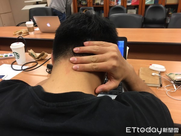 ▲後腦痛。(圖/記者嚴云岑攝)