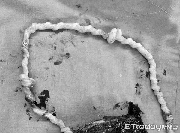 ▲▼。(圖/翻攝自施景中醫師提供)