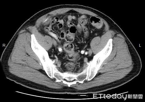 ▲▼。(圖/高醫附設醫院提供)