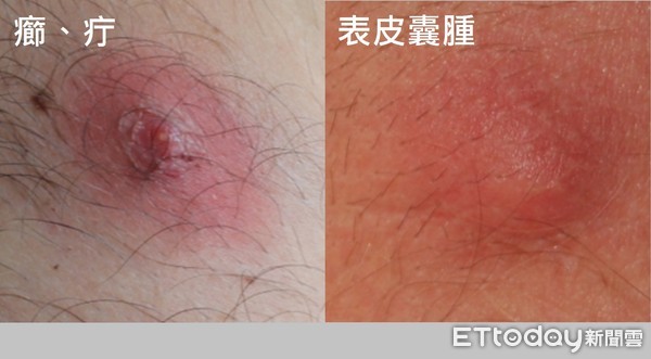 ▲▼非當事者。(圖/郭康凌醫師提供)