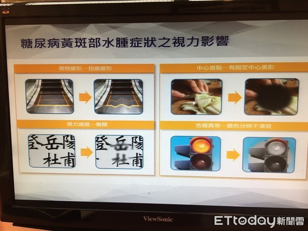 ▲糖尿病衛教機器進駐長庚眼科。(圖/記者嚴云岑攝)