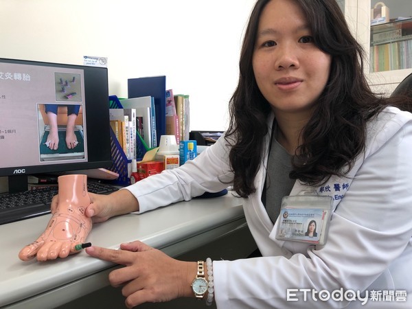 ▲▼艾灸,胎位不正,懷孕,中醫。(圖/高雄醫學大學附設醫院提供)