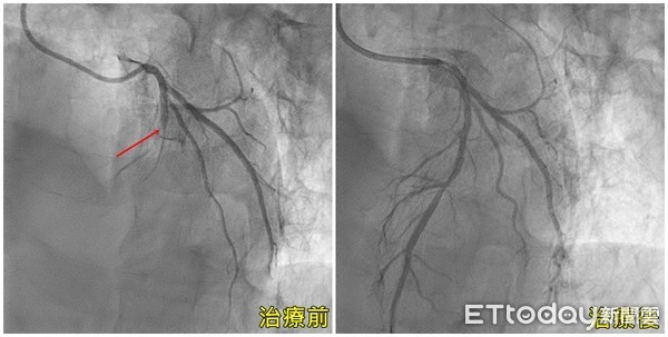 ▲▼運將暈倒狂電6次生還。(圖/亞洲大學附設醫院提供)