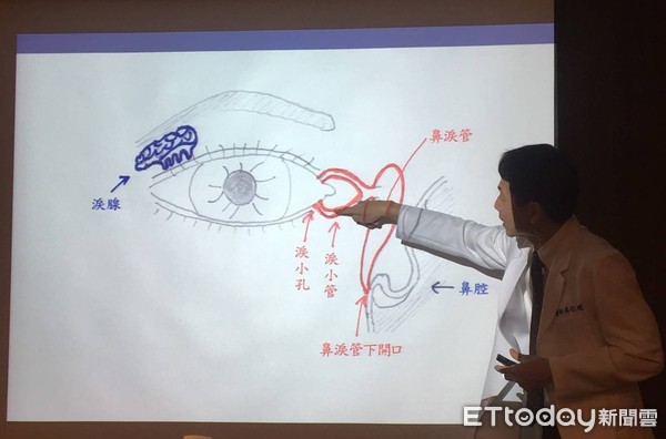 ▲ 點完眼藥水喉嚨苦 別怕!醫師用「一張圖」解釋給你聽。(圖/記者嚴云岑攝)