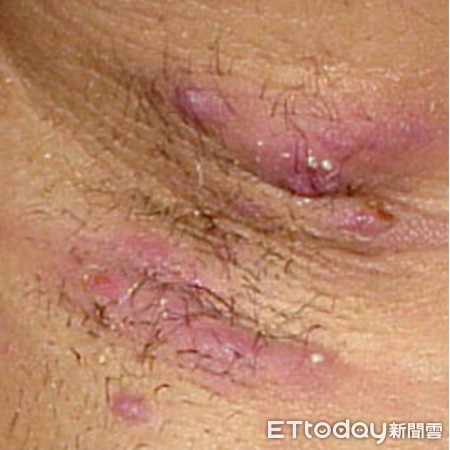 ▲(圖/非當事者/郭康凌醫師提供)