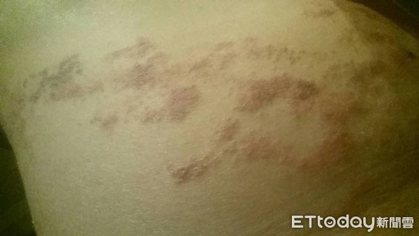 ▲乾掉的皮蛇。(圖/立達診所提供)