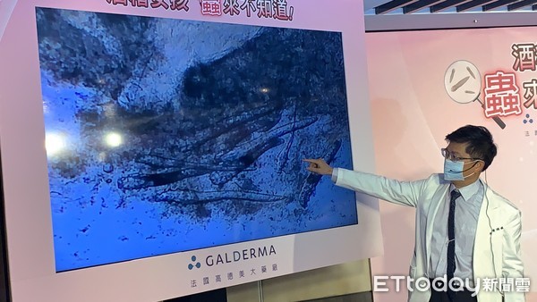 ▲她臉紅發癢竟是「蟲」入侵! 1cm²抓500多隻「連睫毛都有」。(圖/記者嚴云岑攝)