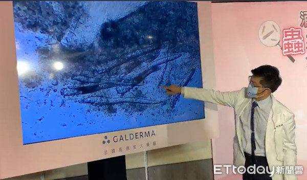 ▲網美卸妝雙頰泛紅 醫擠毛囊揪出「一團活蟲」...腳還在抽動。(圖/記者嚴云岑攝)