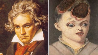貝多芬「頭皮潰爛」噴香水蓋臭味！歐洲名人華麗假髮的真相：染上梅毒