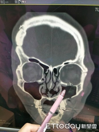 ▲▼。(圖/童綜合醫院提供)