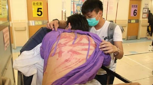 ▲香港元朗多名市民遭「白衣人」毆打。（圖／翻攝自臉書／‎巴打絲打Facebook Club）